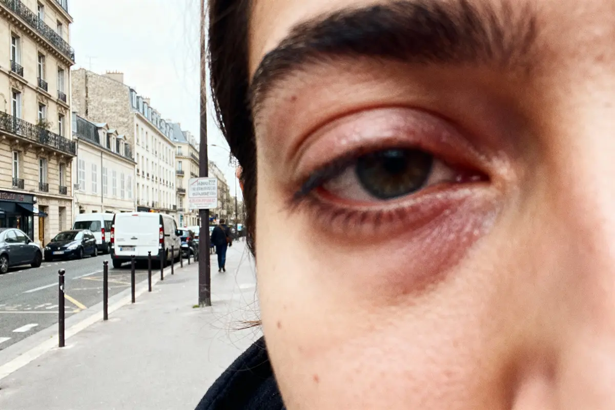 Gros plan sur l'œil gauche d'une personne dans une rue urbaine avec bâtiments et voitures.